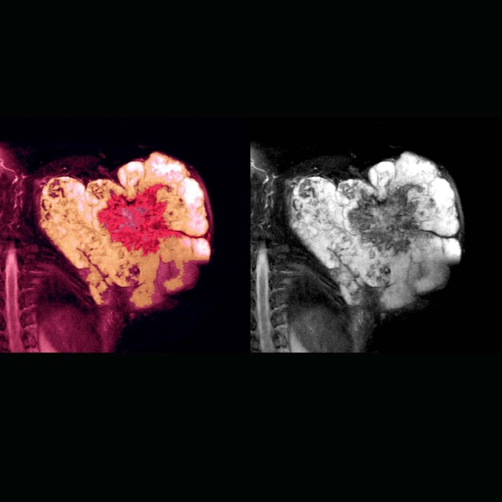 Close view of a hand checking a lump on an arm