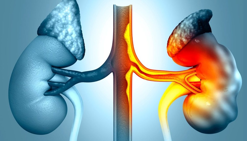 Clinical illustration representing valve treatment options