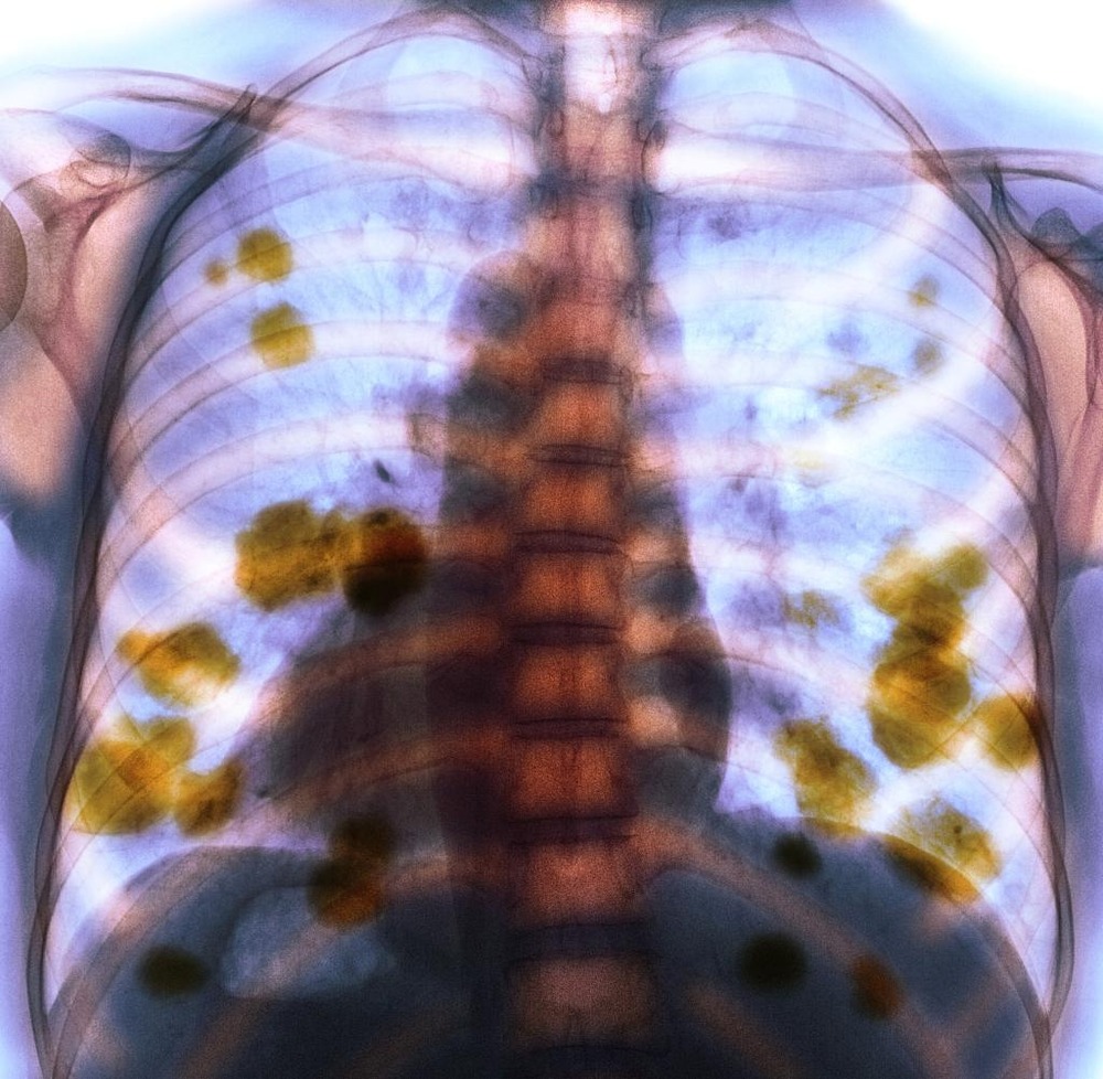 Owner gently watching a dog at rest