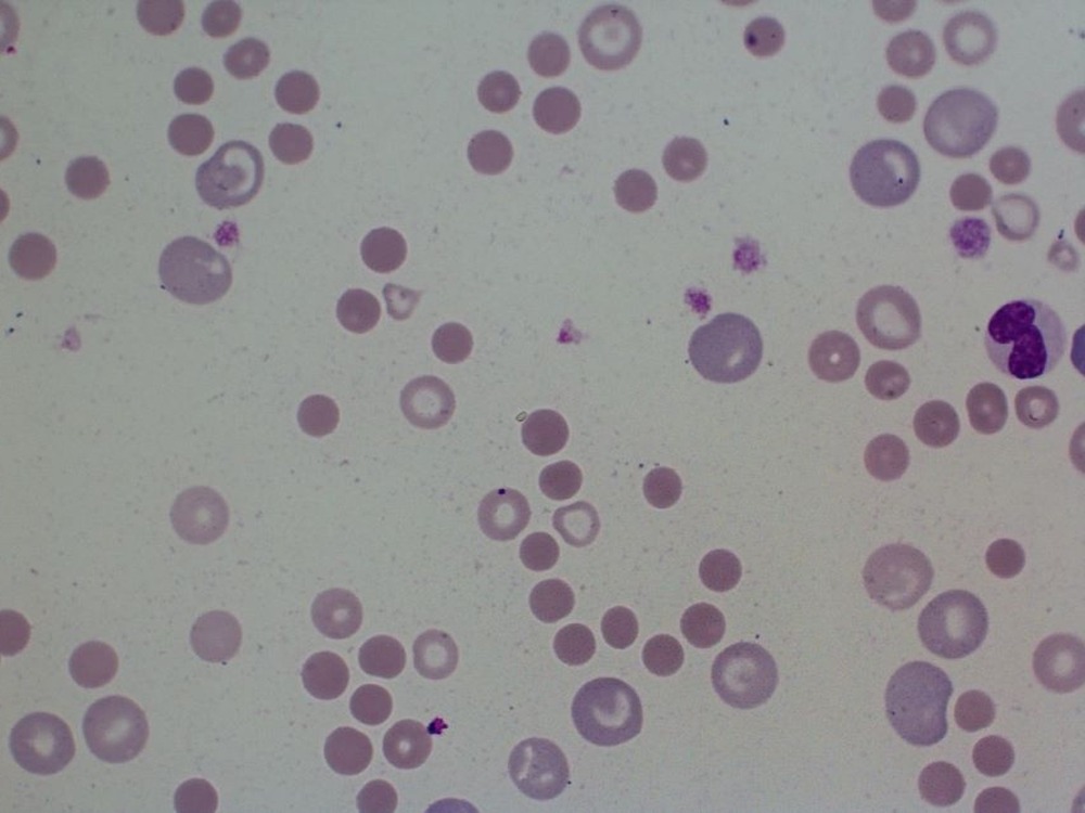 Owner looking at a dog resting at home