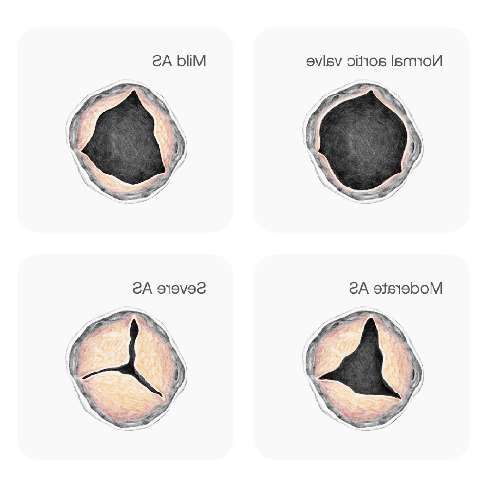 Simple diagram suggesting heart ultrasound assessment