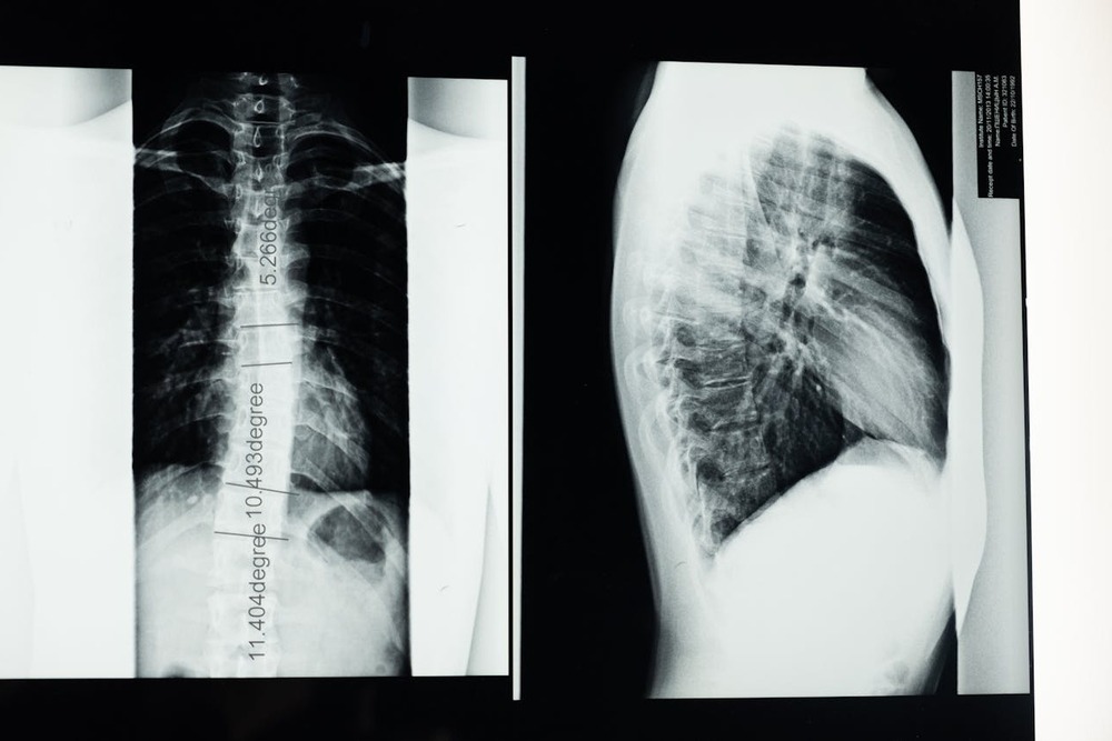 Dog being gently supported while standing