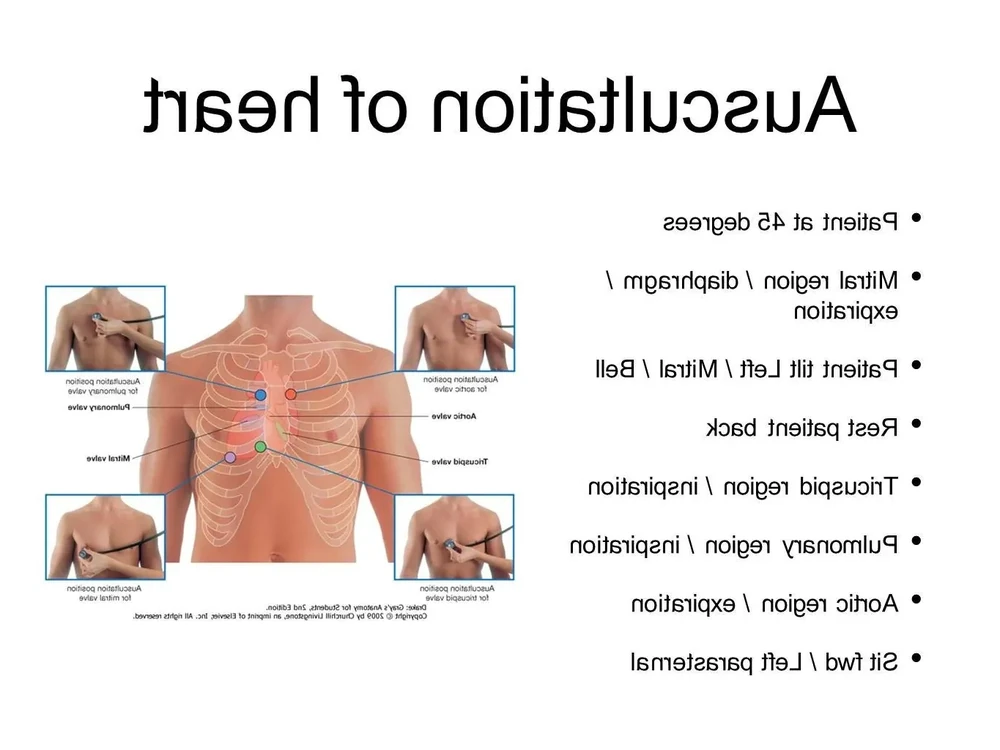 Echocardiogram screen showing the heart