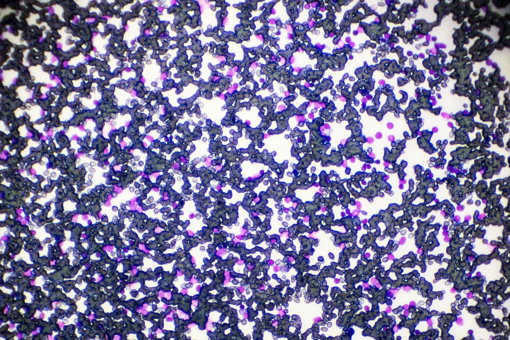 Owner comforting a dog during recovery