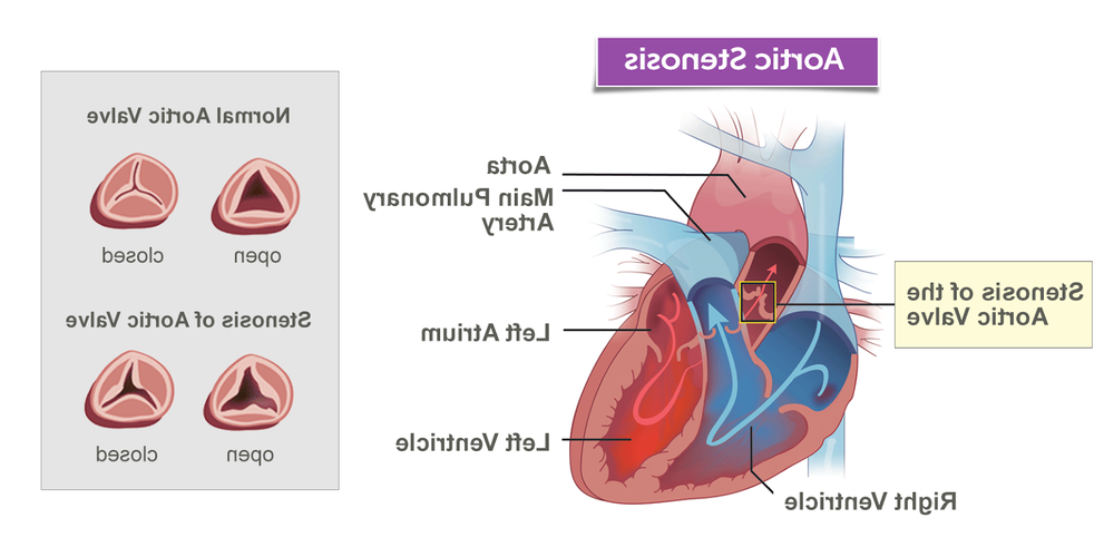 Illustration of the aortic valve opening