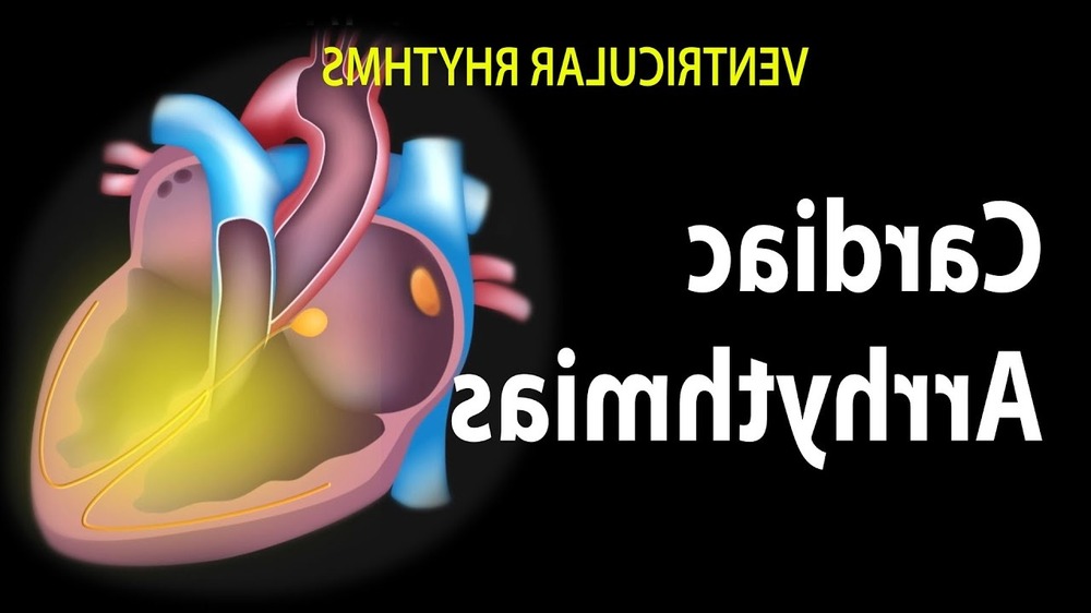 Simplified ECG line showing irregular rhythm pattern