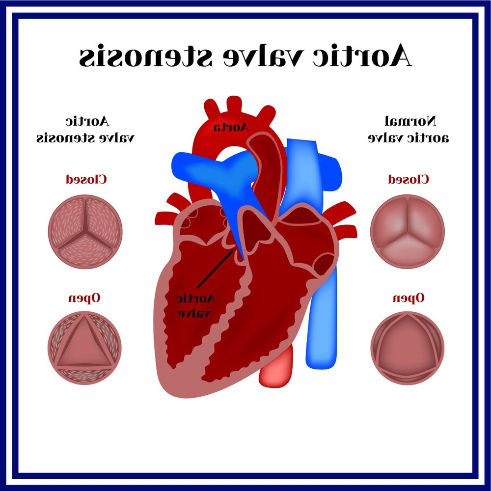 Person walking, representing gradual activity and monitoring
